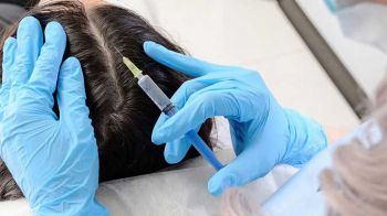 Folik&uuml;ler H&uuml;cre Emplantasyonu