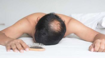 Sa&ccedil; D&ouml;k&uuml;lmesi Nedenleri